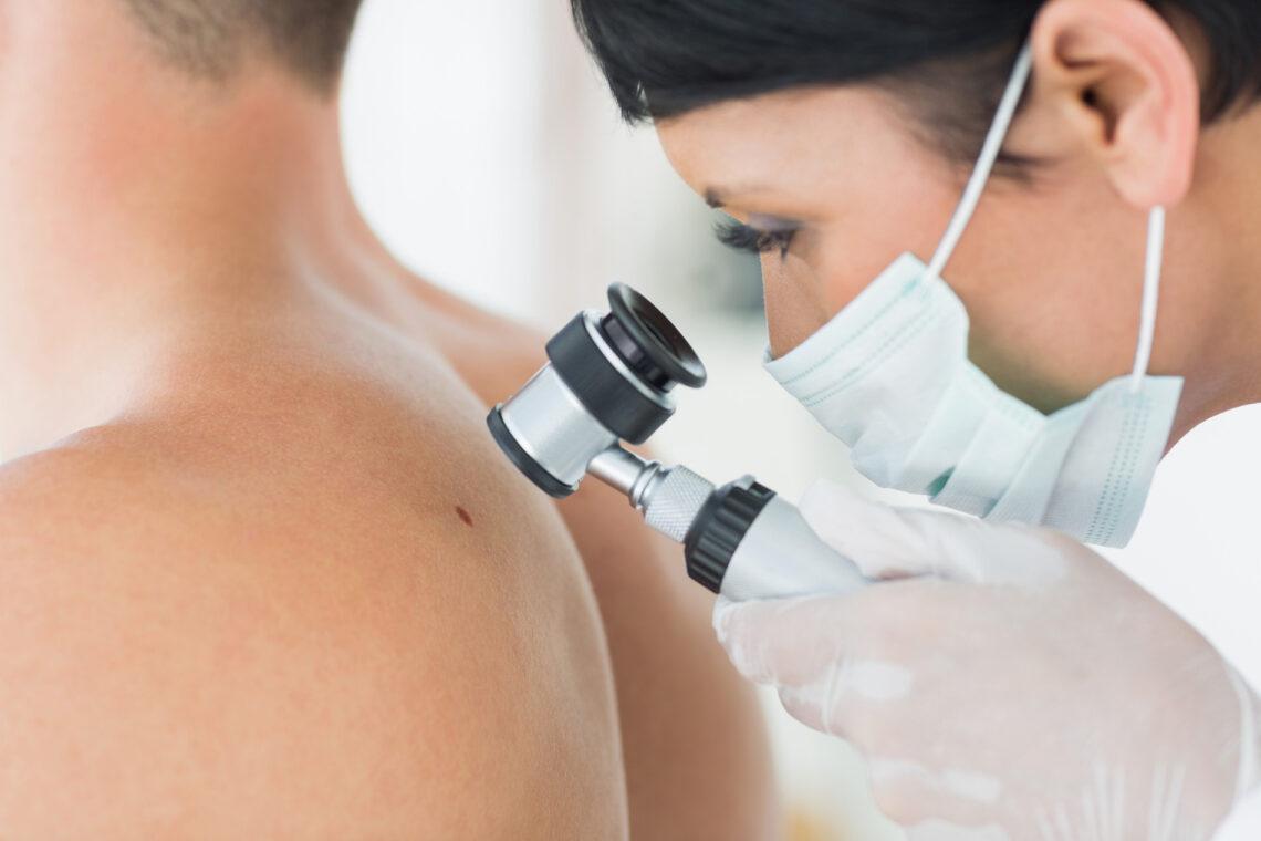 При подозрении на злокачественные процессы берется кусочек кожи для гистологического исследования