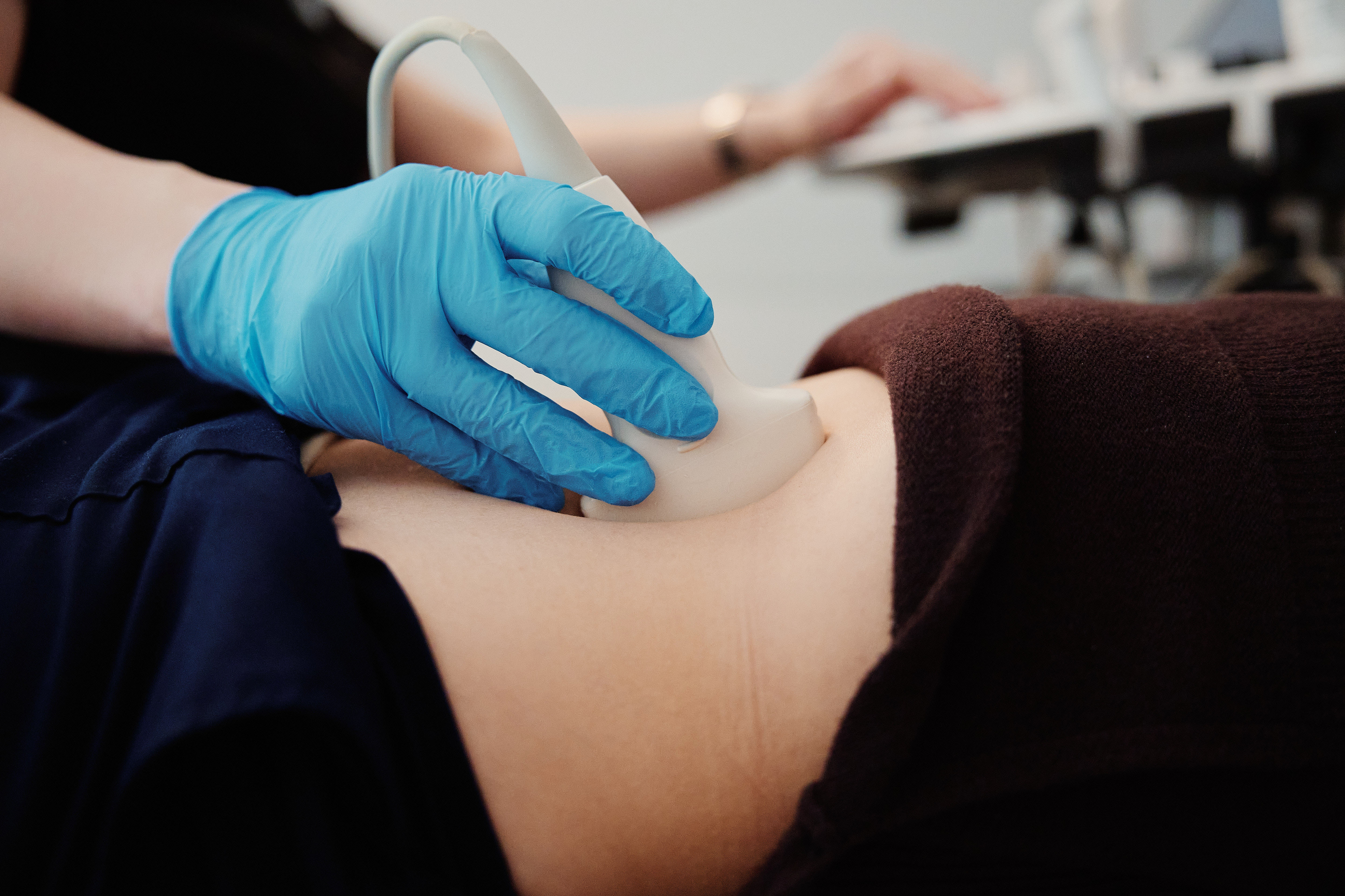 Врач ведёт конвексный датчик по животу пациентки во время УЗИ печени с эластометрией