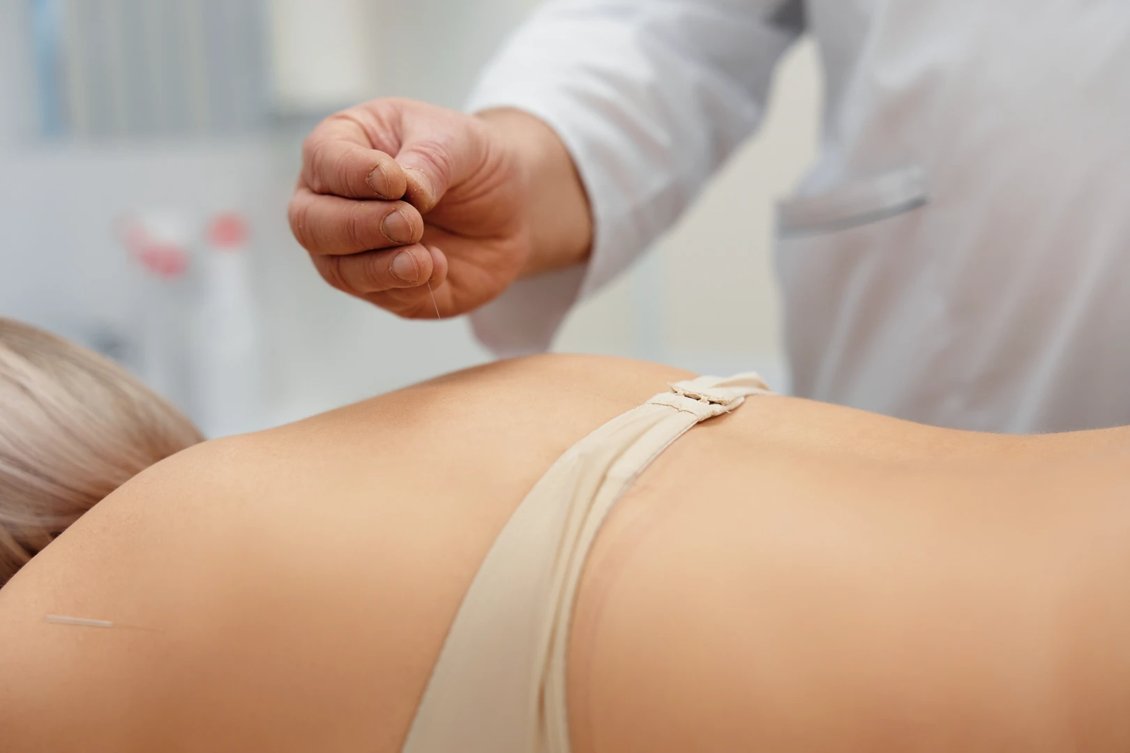 Врач проводит иглоукалывание при остеохондрозе