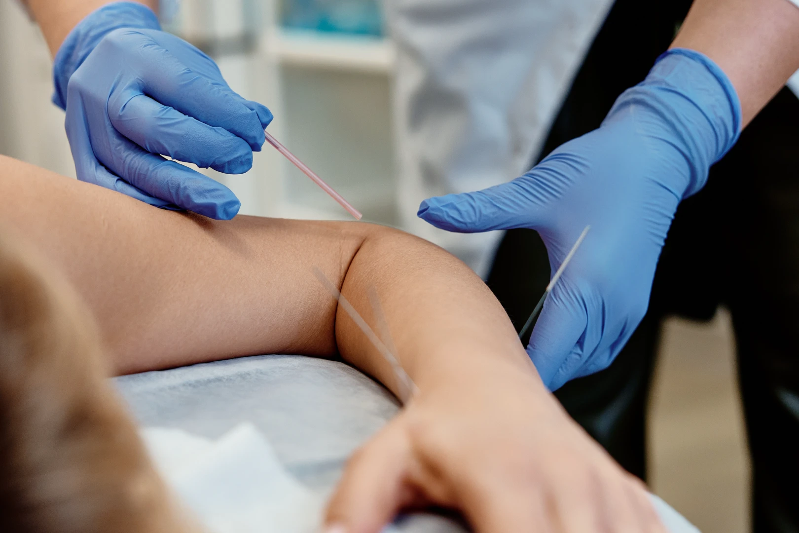 Врач проводит остеорефлексотерапию